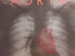 aorta-disco-1969-album-review-critica-psicodelia